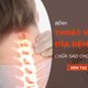 Illustration for article titled Phác đồ điều trị thoát vị đĩa đệm gồm 3 phương pháp chính